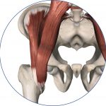 Lesiones de la cadera. Cirugia conservadora