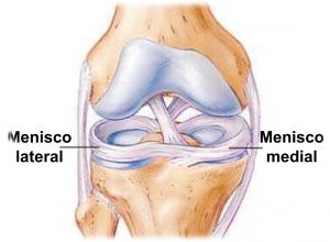 Lesiones de menisco. Partes