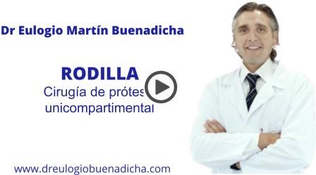 Video de prótesis de rodilla